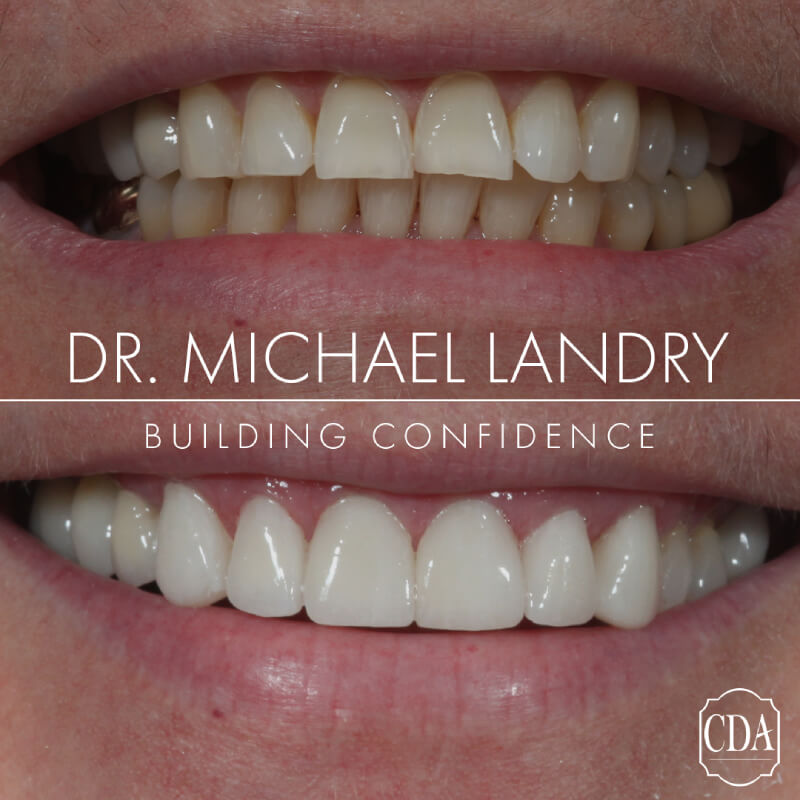 Aesthetic Dentistry in Spring, TX Consultants In Dental Aesthetics